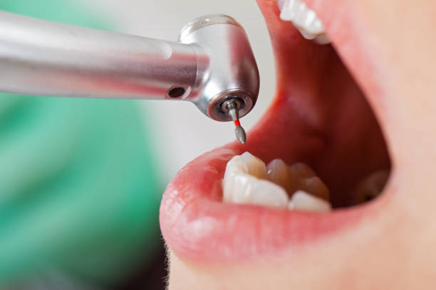 Best Weekend Emergency Dentist in Jacksboro, TN